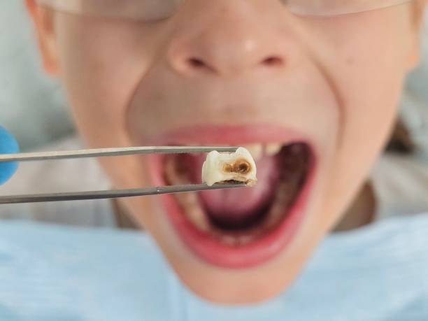Best Walk-In Emergency Dental Services in Dixon, CA